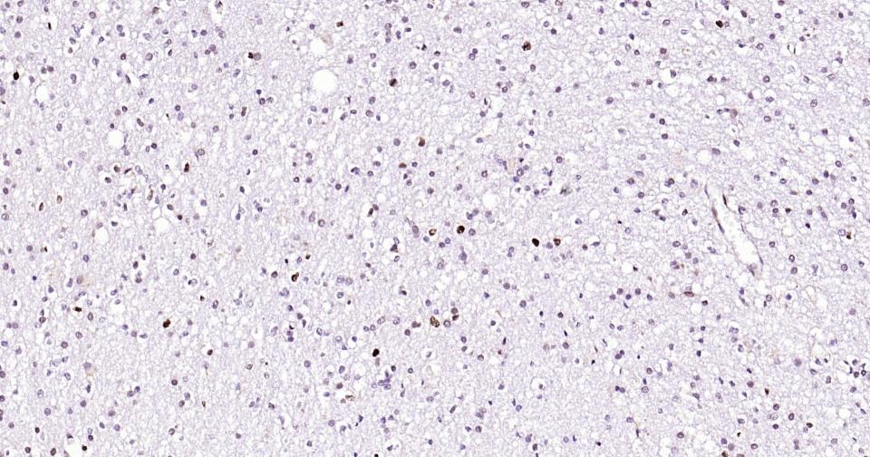Anti-PCNA Polyclonal Antibody 2