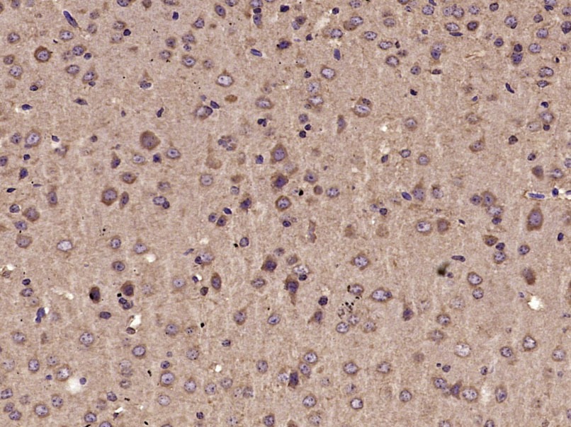 Anti-Parvalbumin/PVALB Polyclonal Antibody