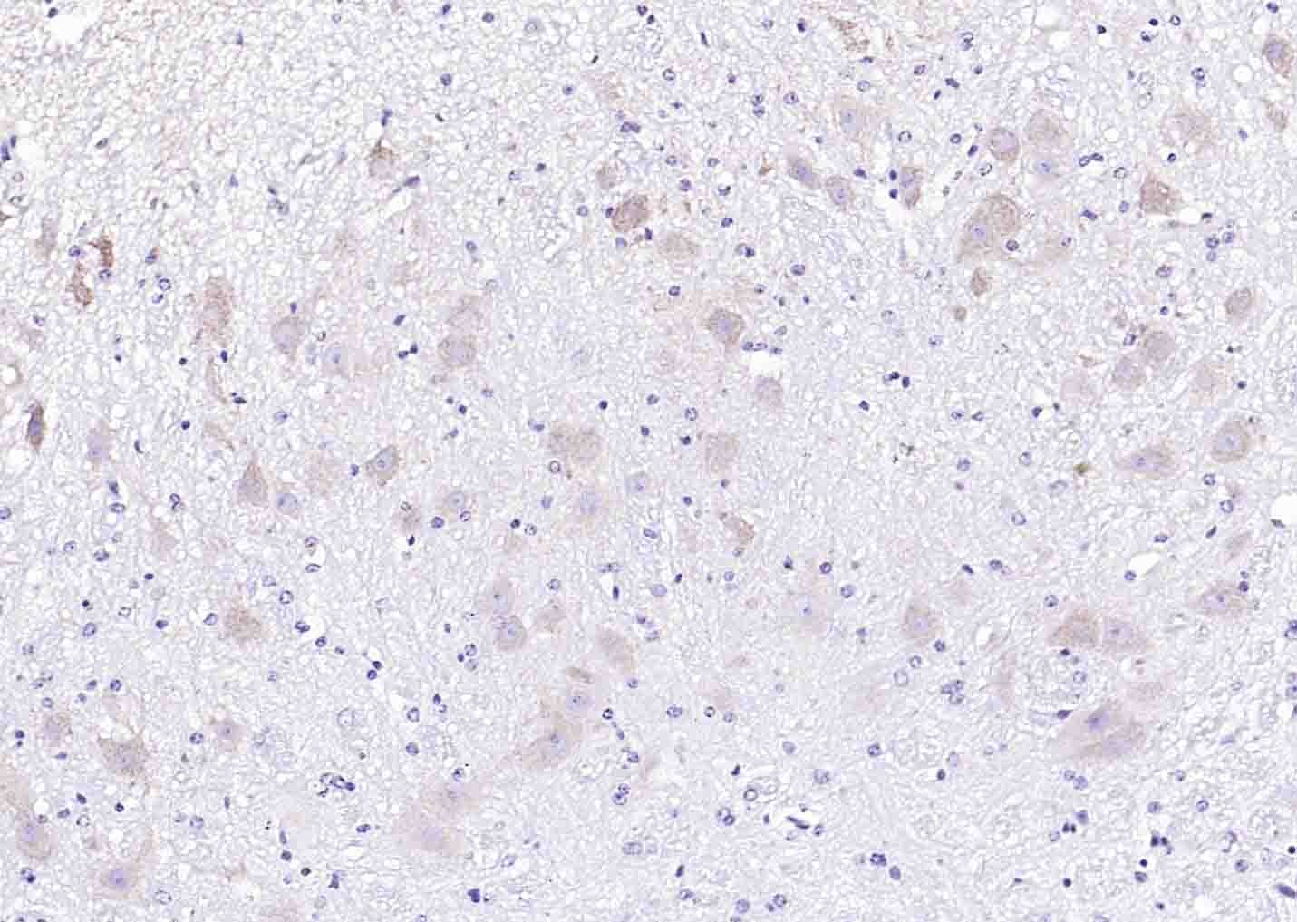 Anti-PCSK9 Polyclonal Antibody