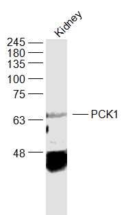 Anti-PCK1 Polyclonal Antibody