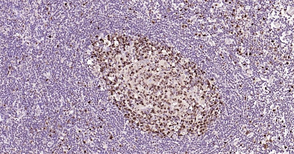 Anti-PCNA Polyclonal Antibody 2