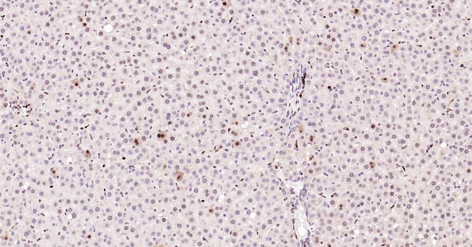 Anti-PCNA Polyclonal Antibody 2