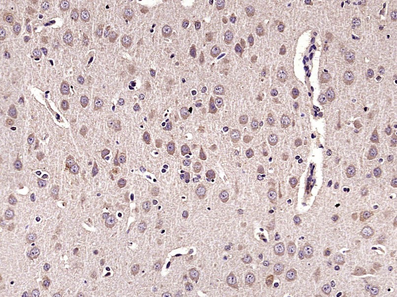 Anti-Parvalbumin/PVALB Polyclonal Antibody