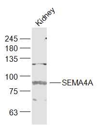 Anti-SEMA4A Polyclonal Antibody