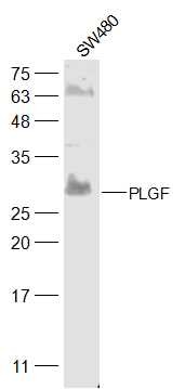 Anti-PLGF/PGF Polyclonal Antibody