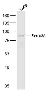 Anti-SEMA3A Polyclonal Antibody