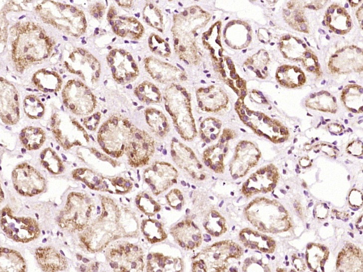 Anti-PLA2R Polyclonal Antibody