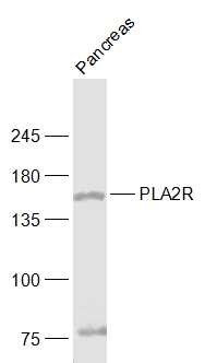 Anti-PLA2R Polyclonal Antibody
