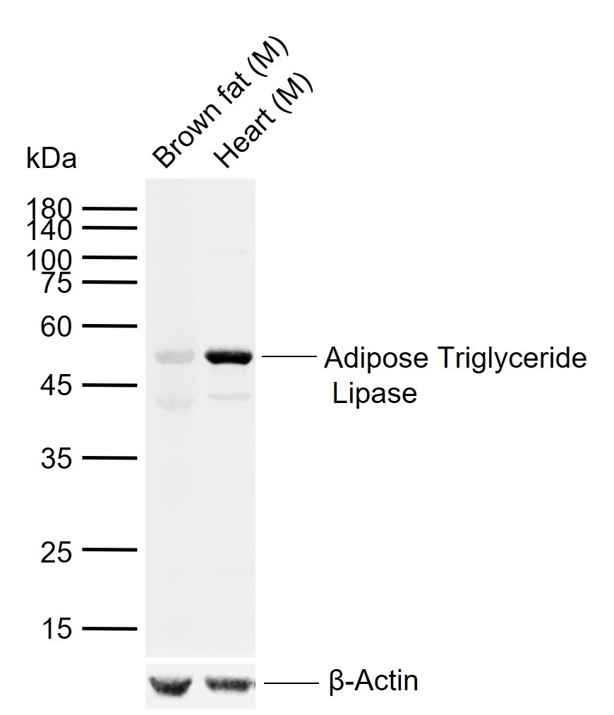 Anti-PNPLA2 Polyclonal Antibody