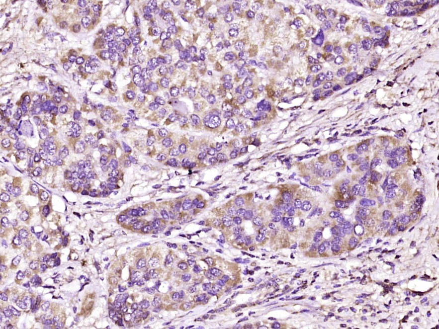 Anti-SEMA4A Polyclonal Antibody
