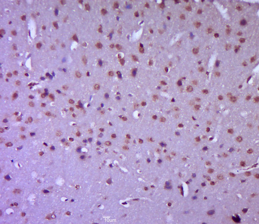 Anti-Plzf Polyclonal Antibody