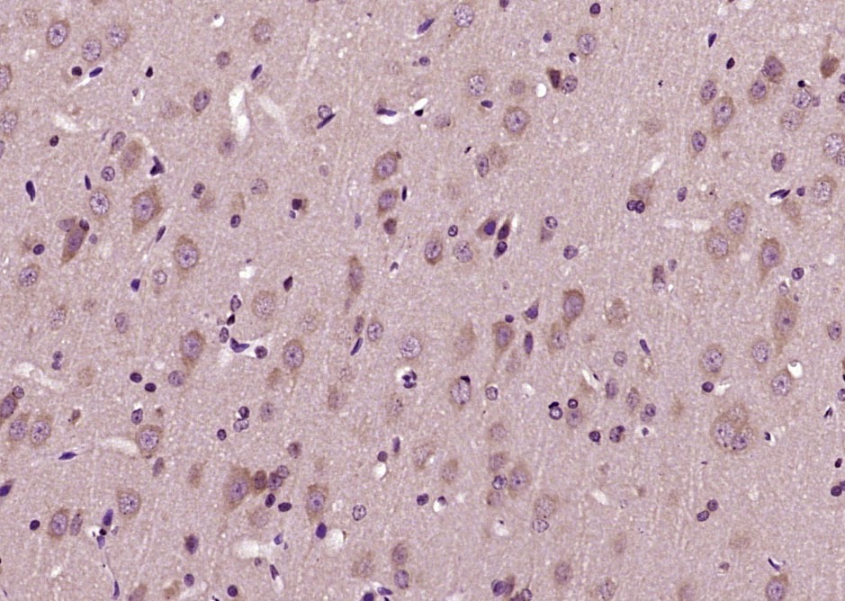 Anti-PLVAP Polyclonal Antibody