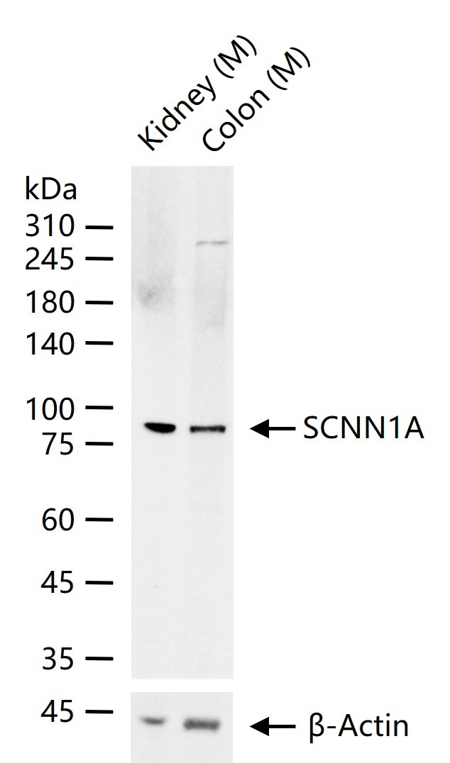 Anti-SCNN1A Polyclonal Antibody
