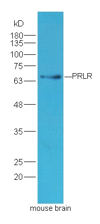 Anti-PRLR Polyclonal Antibody