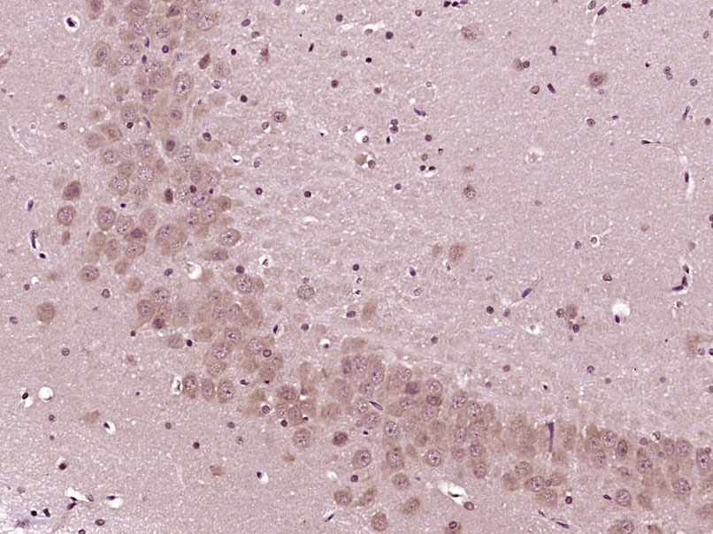 Anti-CGRP-I Polyclonal Antibody