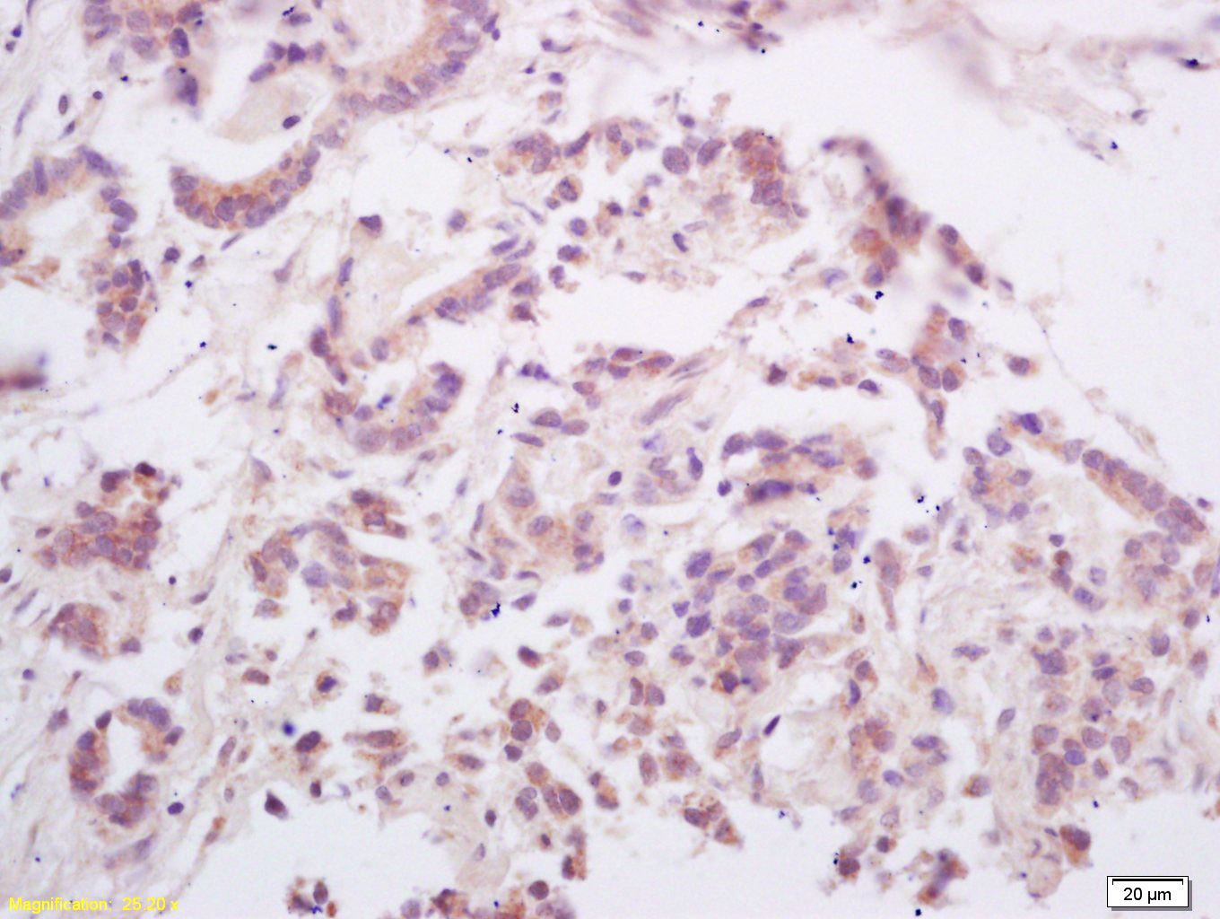 Anti-RANKL/TNFSF11/CD254 Polyclonal Antibody