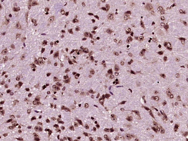 Anti-PRKN Polyclonal Antibody