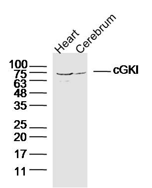 Anti-PRKG1 Polyclonal Antibody