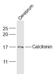 Anti-Calcitonin/CALCA Polyclonal Antibody