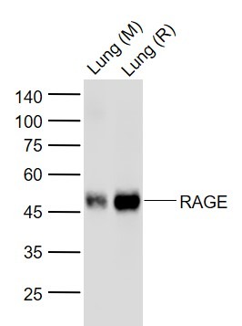 Anti-RAGE Antibody (1W320)