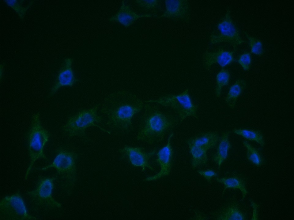 Anti-PRKG1 Polyclonal Antibody