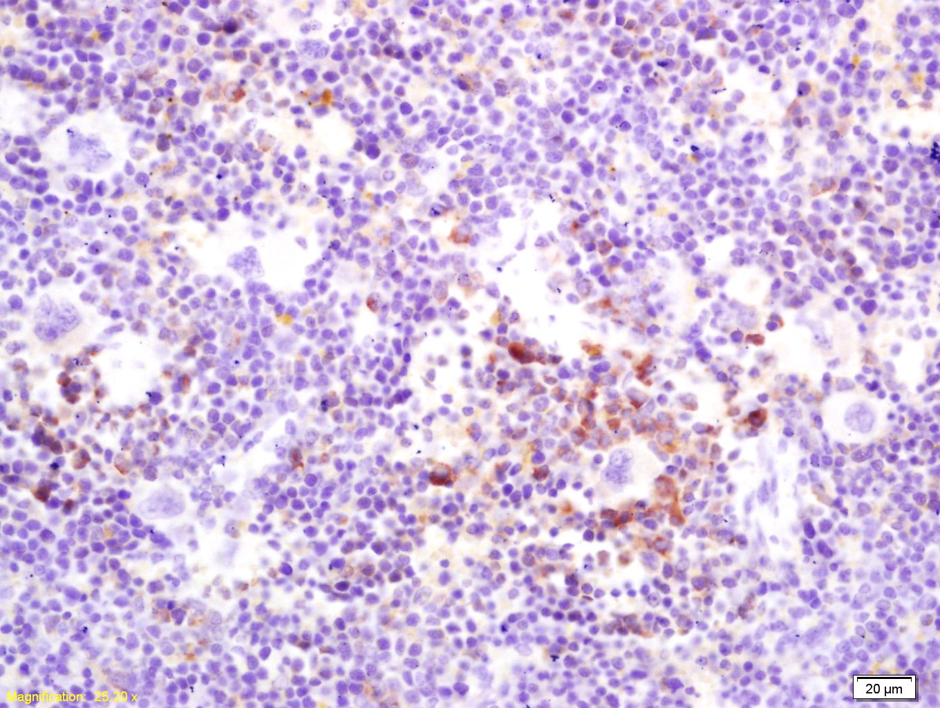 Anti-RANKL/TNFSF11/CD254 Polyclonal Antibody