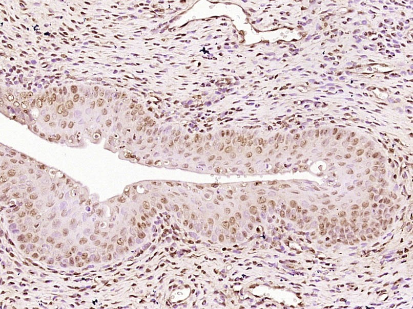 Anti-Progesterone Receptor Polyclonal Antibody