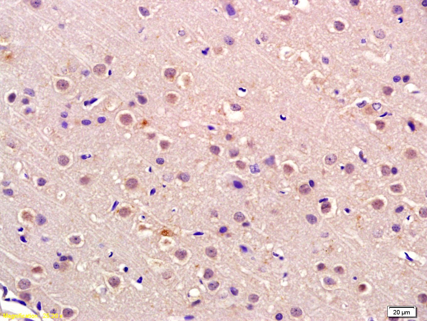 Anti-Rb Polyclonal Antibody