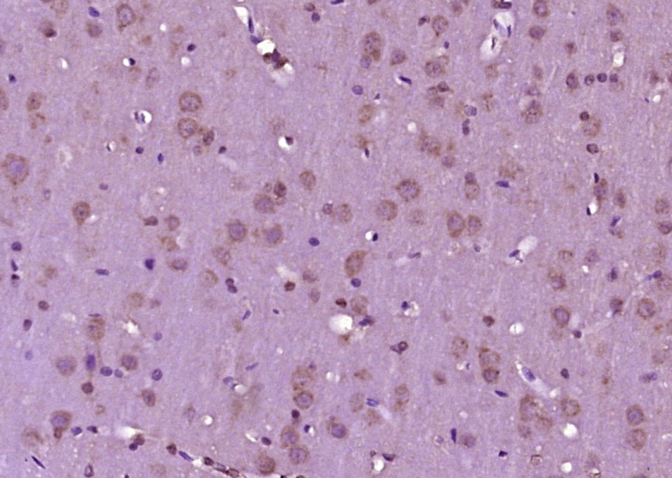 Anti-CGRP-I/II Polyclonal Antibody