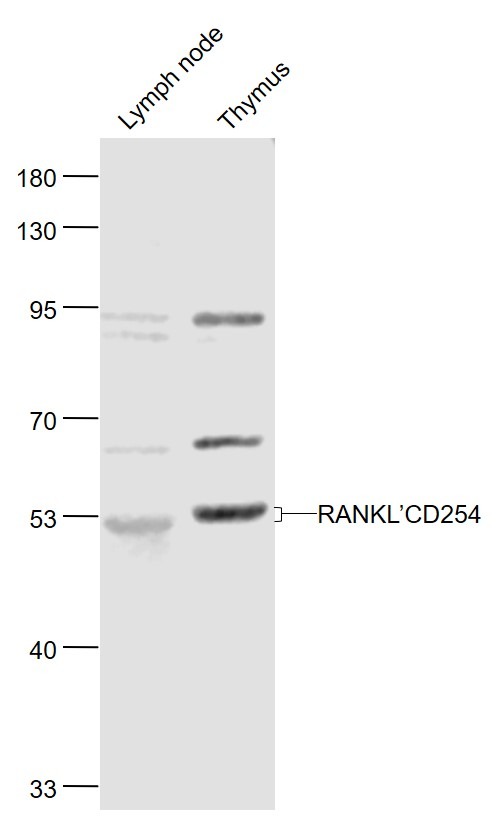 Anti-RANKL/TNFSF11/CD254 Polyclonal Antibody