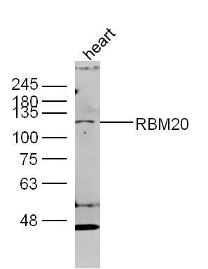 Anti-RBM20 Polyclonal Antibody
