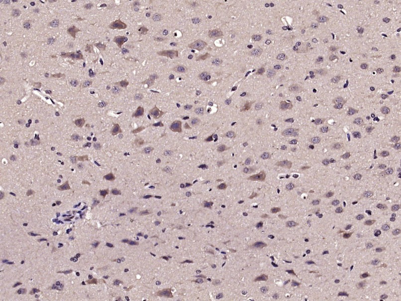 Anti-RIPK1 Polyclonal Antibody