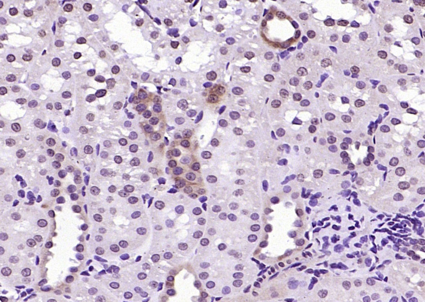 Anti-RGC32/C13orf15 Polyclonal Antibody