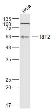Anti-RIPK2 Polyclonal Antibody