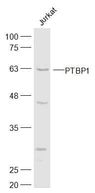 Anti-PTBP1 Polyclonal Antibody