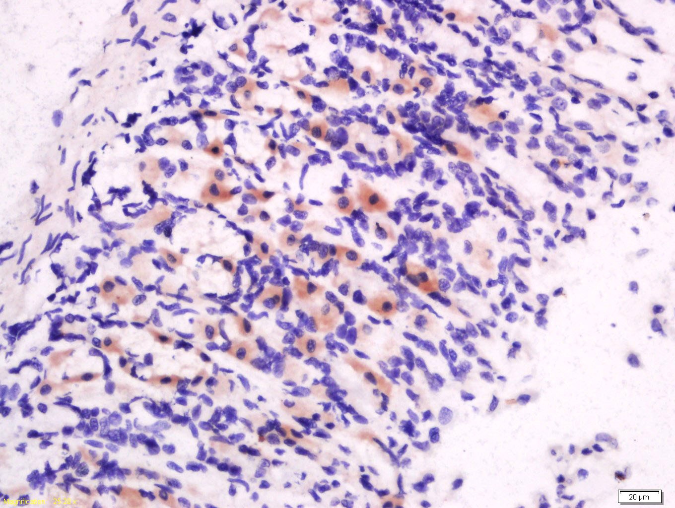 Anti-Promotilin Polyclonal Antibody