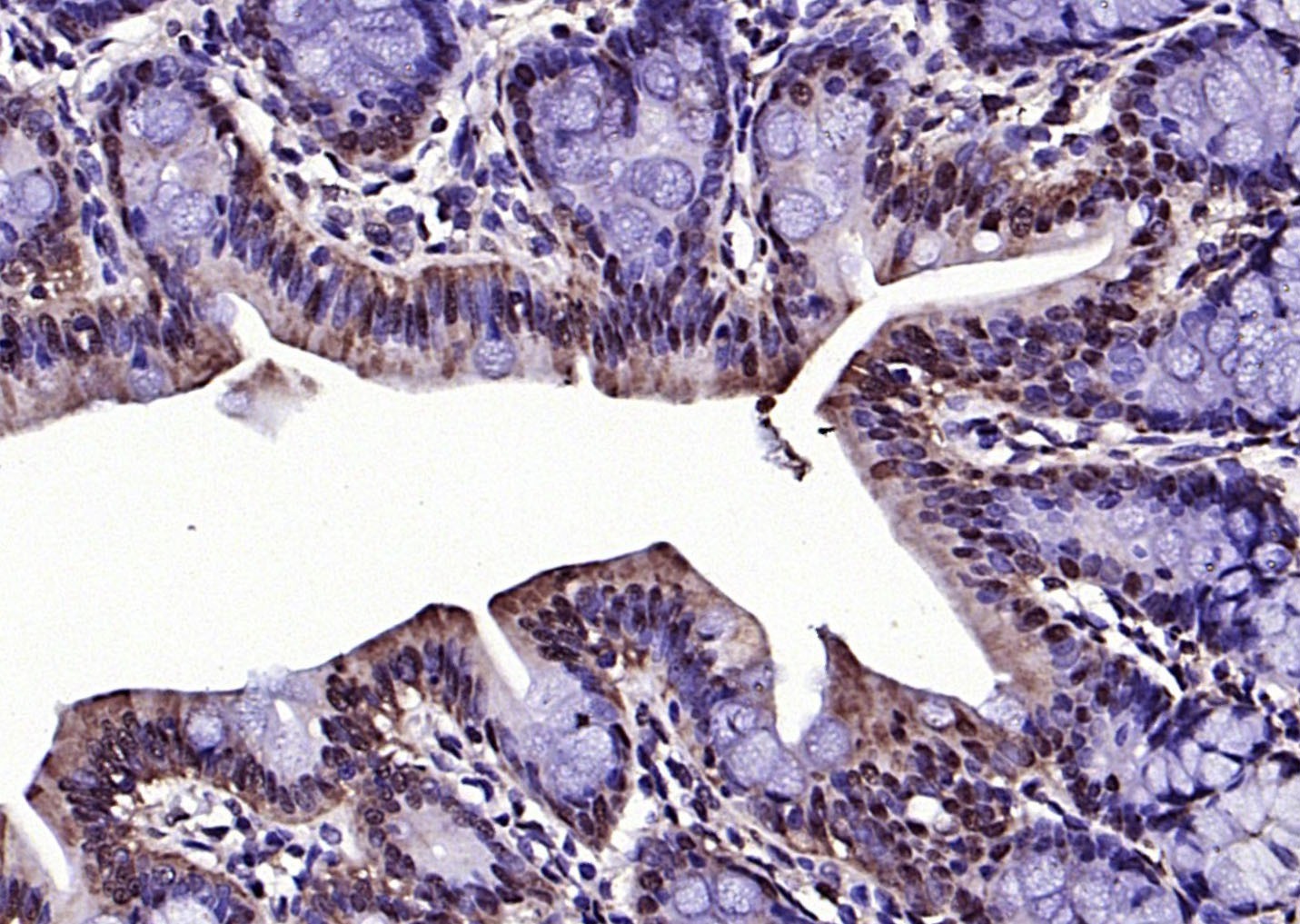 Anti-RGC32/C13orf15 Polyclonal Antibody