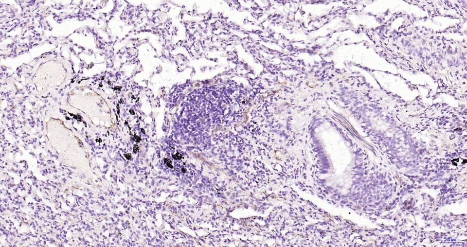 Anti-P-selectin Polyclonal Antibody