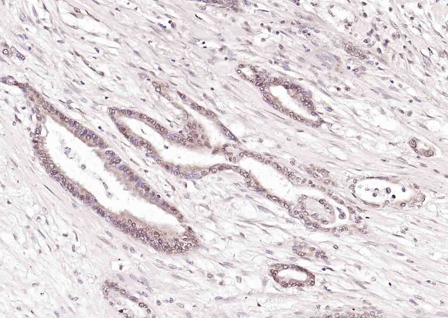 Anti-PTBP1 Polyclonal Antibody