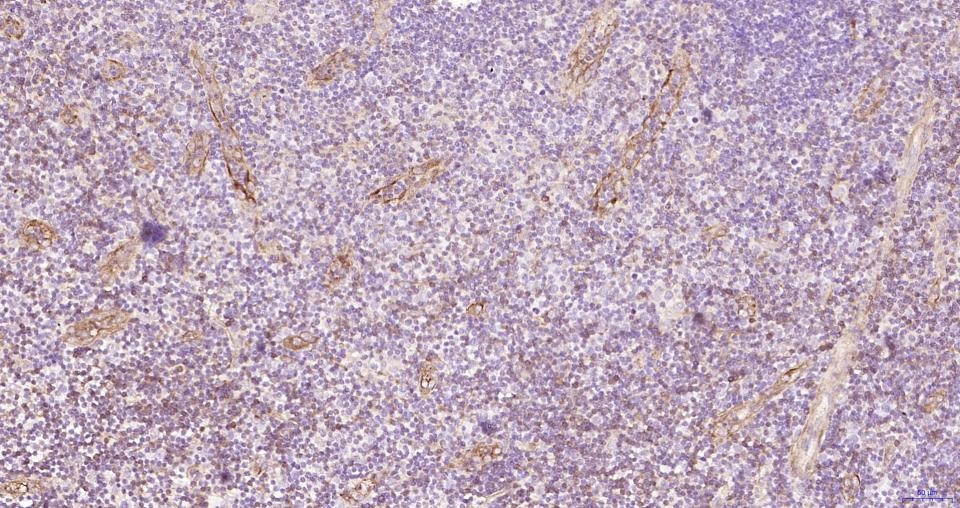 Anti-P-selectin Polyclonal Antibody