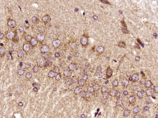 Anti-RIPK3 Polyclonal Antibody