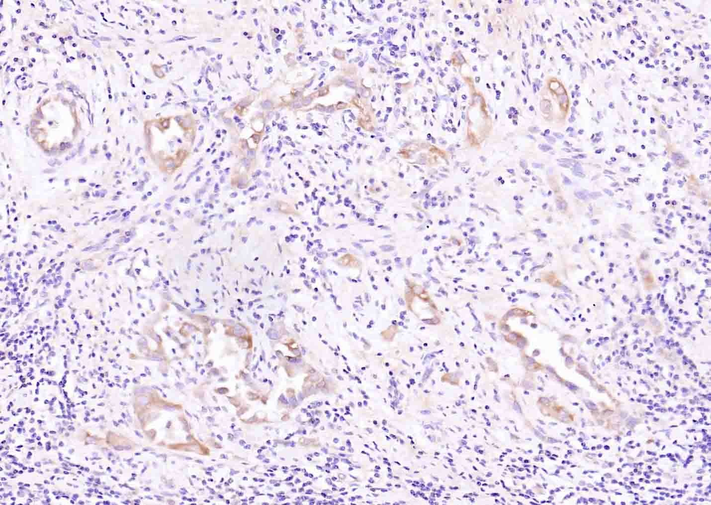 Anti-RIPK1 Polyclonal Antibody
