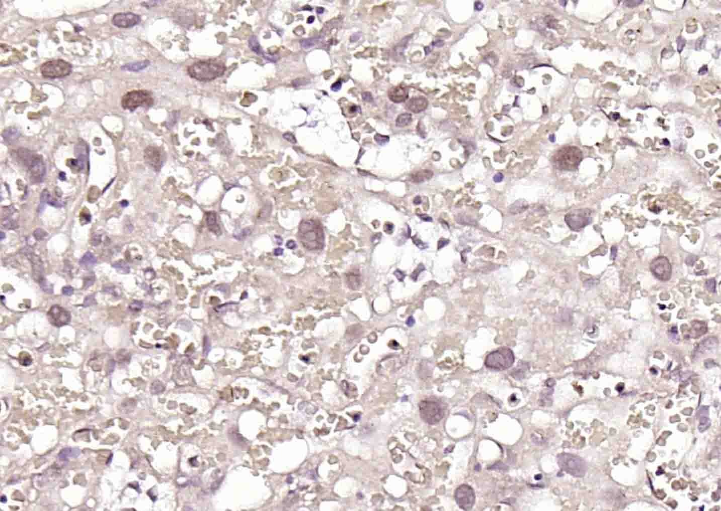 Anti-PTBP1 Polyclonal Antibody