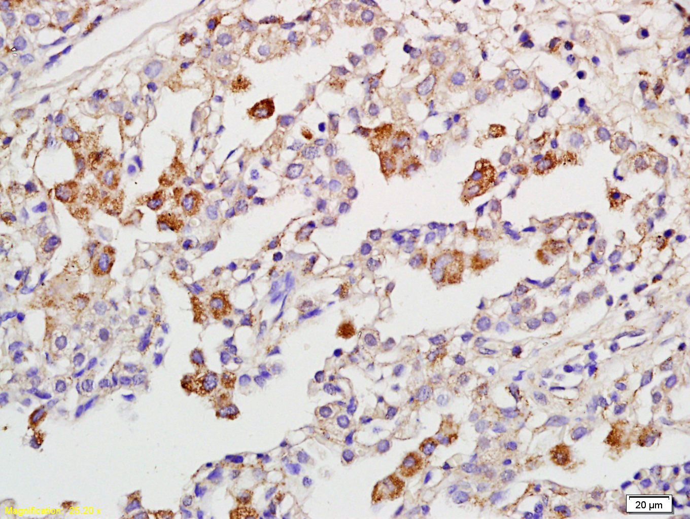 Anti-RIPK3 Polyclonal Antibody