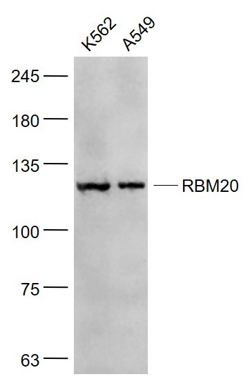 Anti-RBM20 Polyclonal Antibody