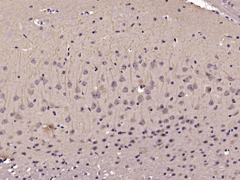 Anti-RIPK1 Polyclonal Antibody