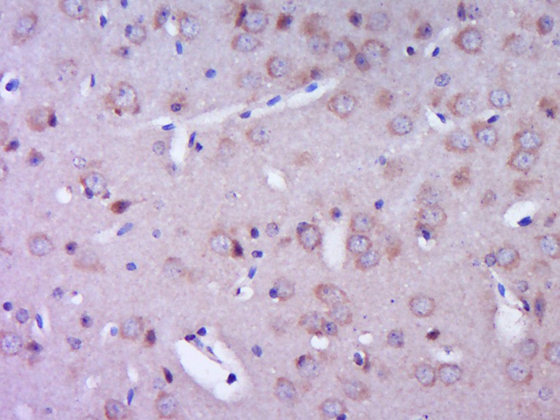Anti-RIPK2 Polyclonal Antibody