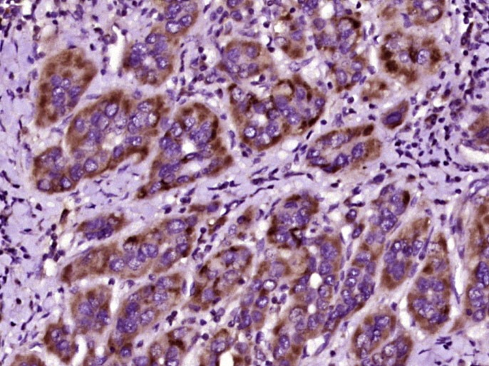 Anti-Prothrombin Polyclonal Antibody