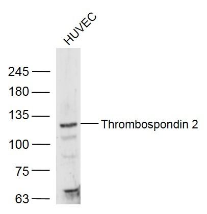 Anti-Thrombospondin-2/THBS2 Polyclonal Antibody
