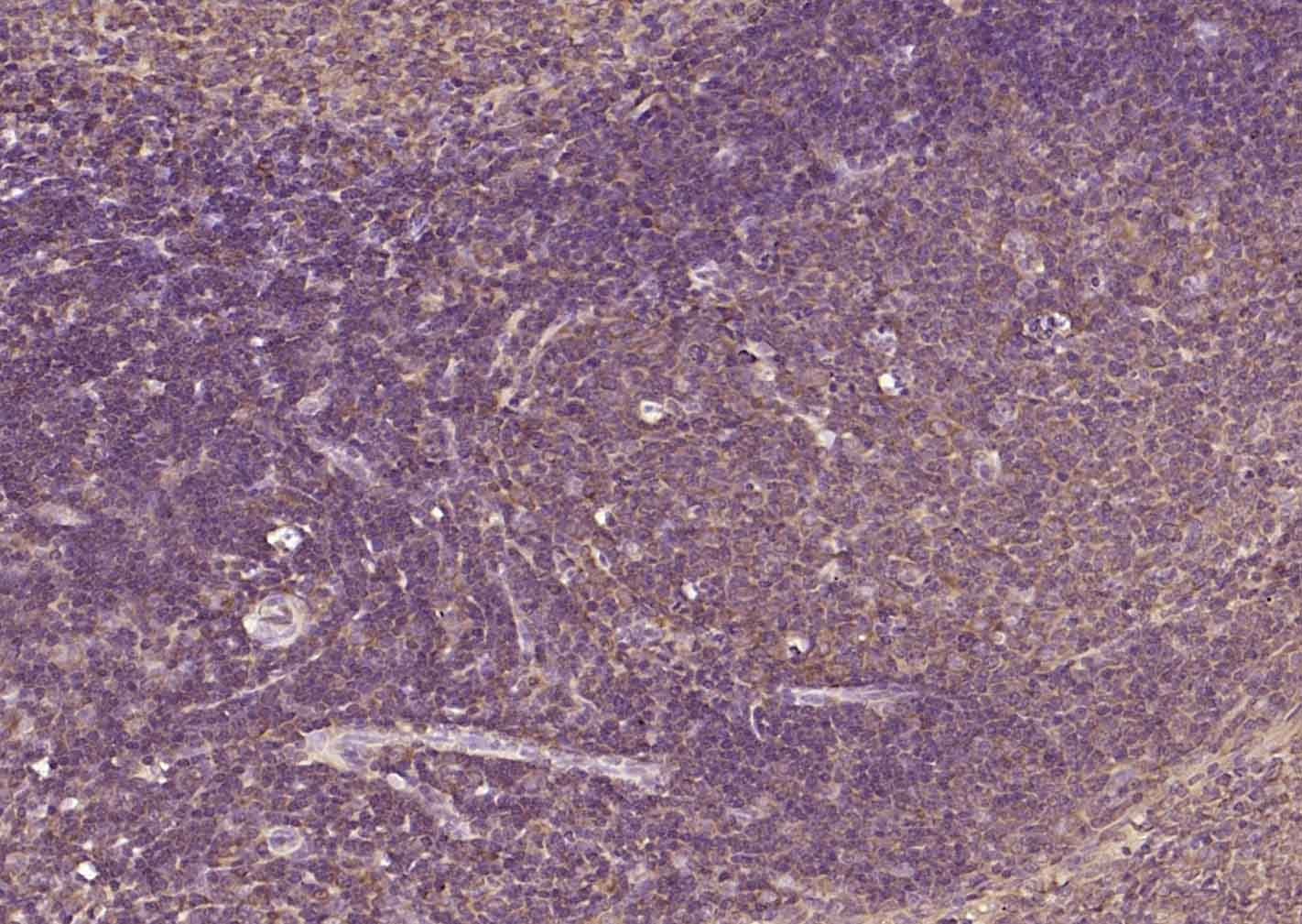 Anti-TGFBR2 Polyclonal Antibody